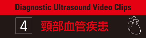 Diagnostic Ultrasound Video Clips 4- 頸部血管疾患
